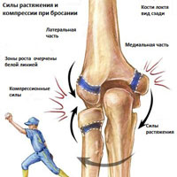 Травмы локтя при бросании